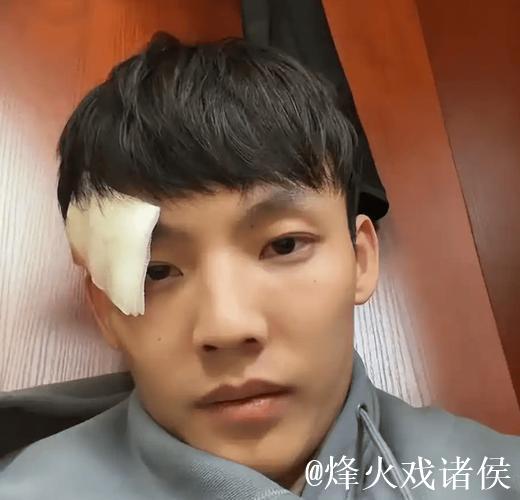 广东迎伤病潮！徐杰眉骨开裂杜润旺肩部撕裂，两新援至今一场没打